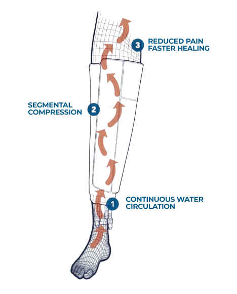 Intermittent compression benefits peak recovery specialists